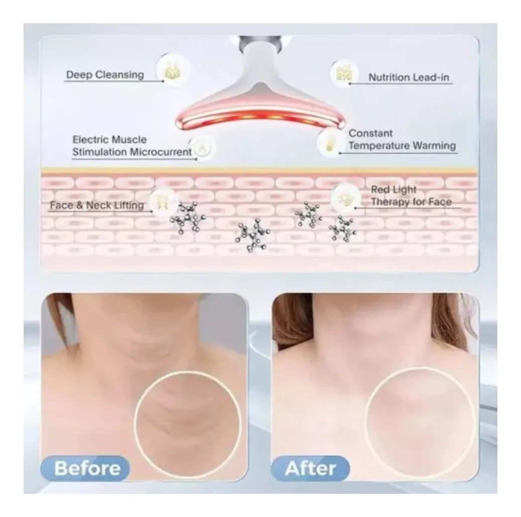 MASAJEADOR FACIAL REDUCTOR DE ARRUGAS